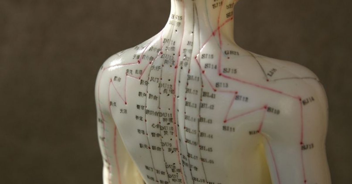 Acupuncture NZ Acupuncture & Chinese Medicine